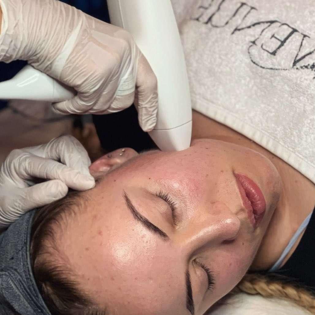 Esthetician performing a skin treatment on a woman's face using a handheld device while she lies with eyes closed.